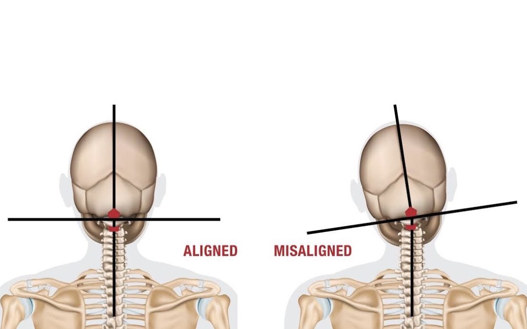 Neck Injury Assistance