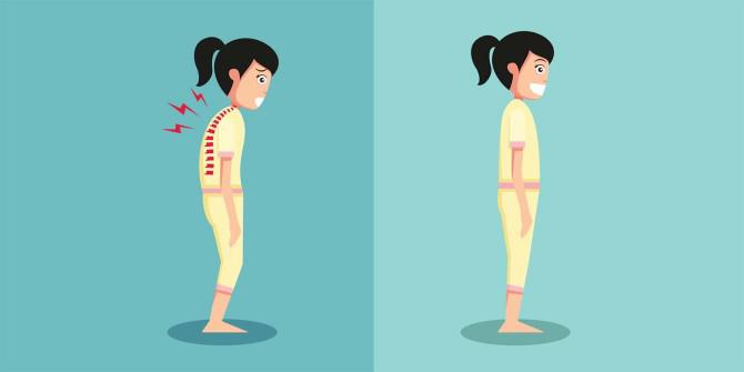 Chiropractic West Bend WI Your Posture Is Not Your Fault