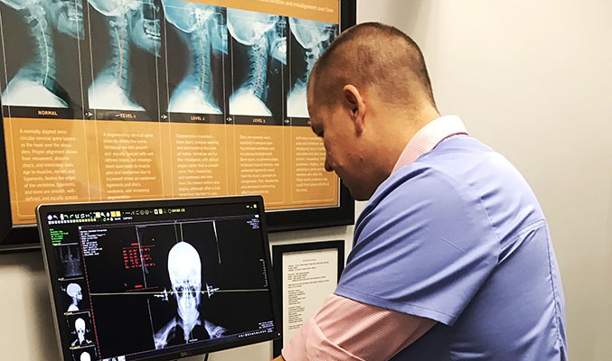 Chiropractor West Bend WI FJ Schofield Reading X-ray