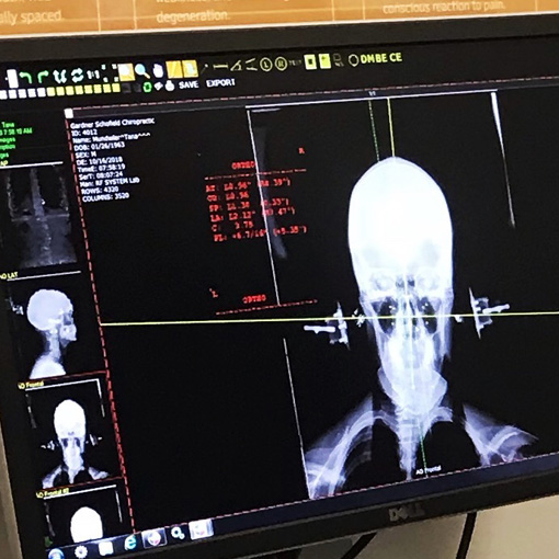 Functional Medicine West Bend WI X-rays